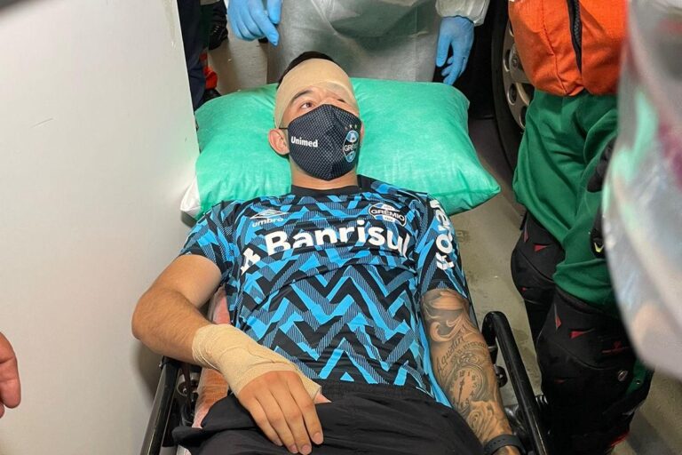 Jogador do Grêmio sofre traumatismo craniano após levar pedrada de torcedor