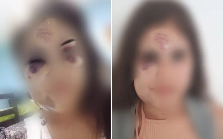 Ex-militar é preso após quebrar mandíbula de mulher e fazer piada