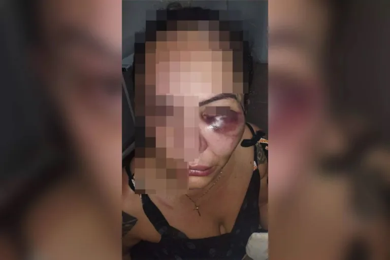 Homem agride, enforca e desfigura rosto de mulher no Entorno