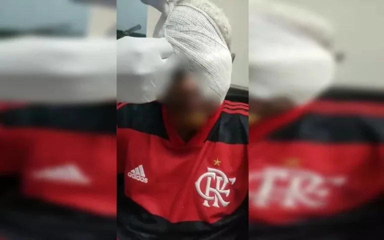 Jovem autista perde olho após ser agredido em quadra de esportes em Águas Claras