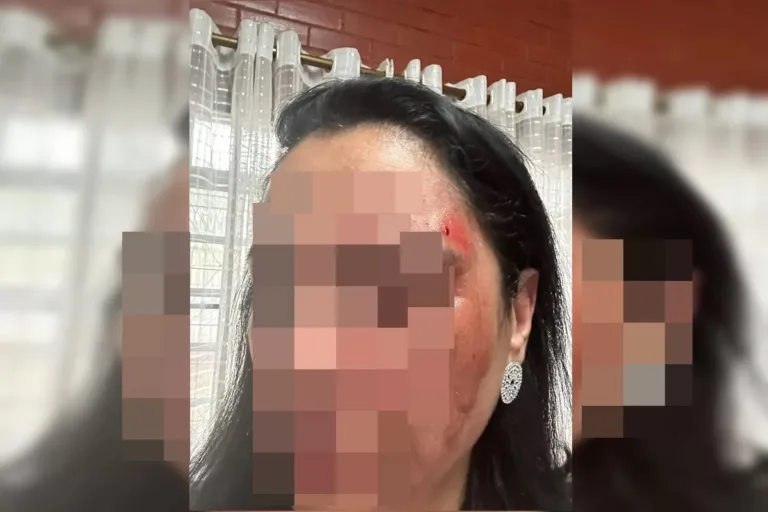Diretora é agredida com pedrada no rosto em escola no Entorno do DF