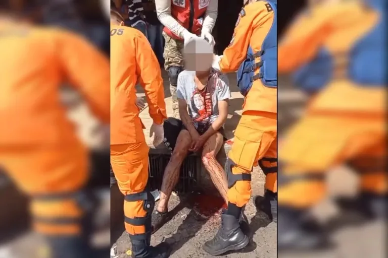 VÍDEO: Jovem leva facada na cabeça durante assalto no DF