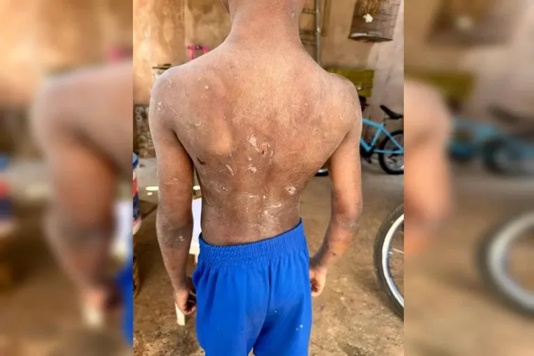 Pai que espancou filho de 9 anos foi liberado após prestar depoimento
